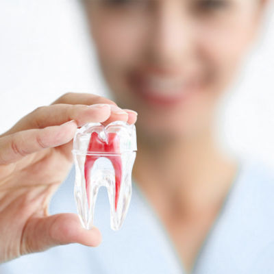 Endodontie-Wurzelbehandlung-Zahnarzt-Schriesheim